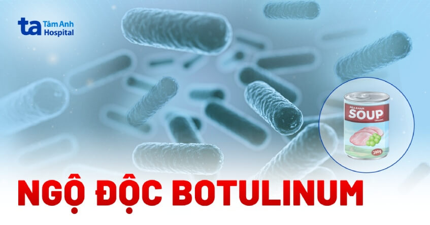 ngộ độc botulinum