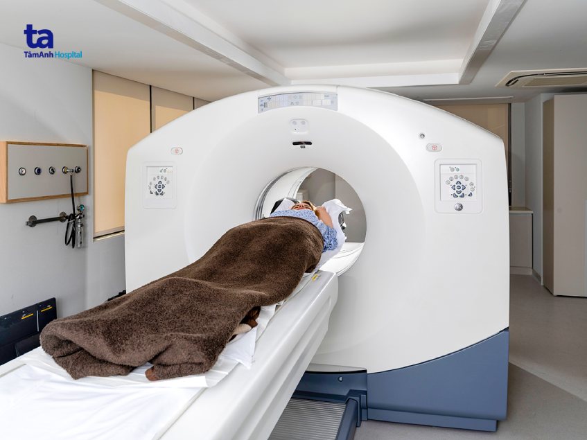 chụp pet/ct để làm gì