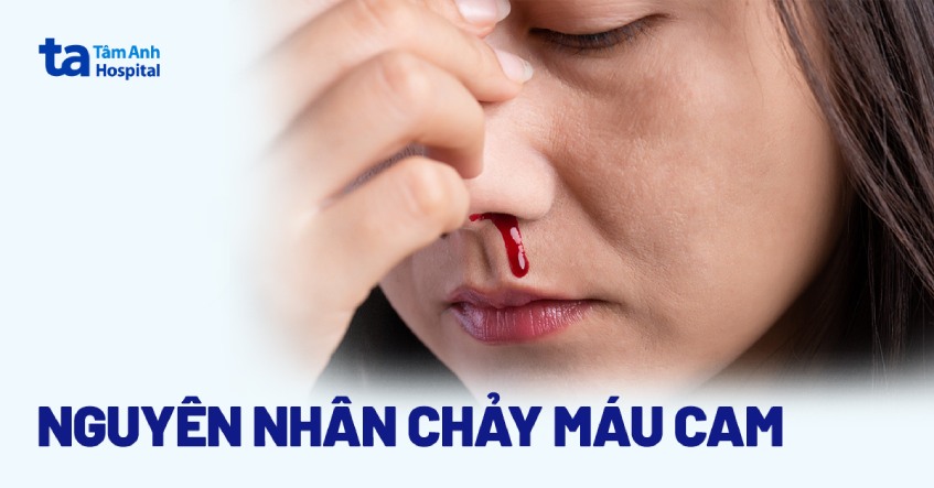 chảy máu mũi