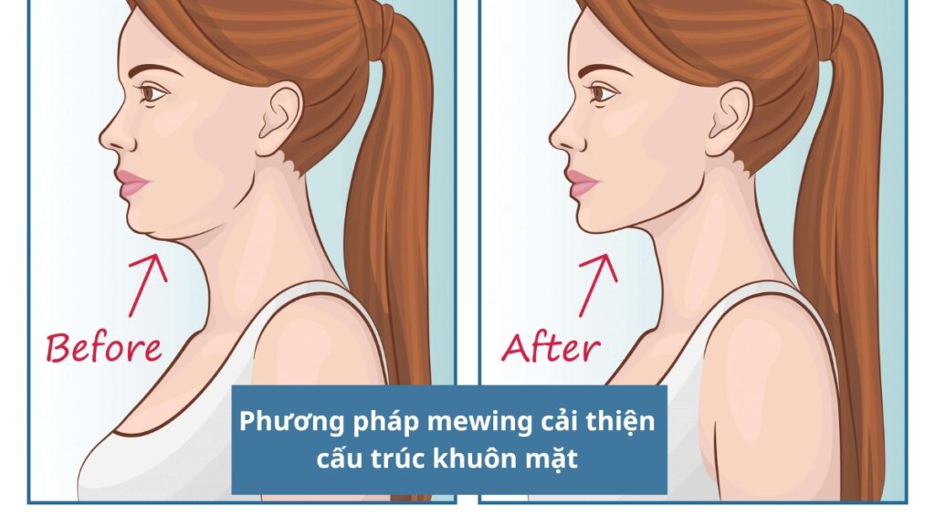 Mewing đúng cách có thể giúp giảm nọng, mặt thon gọn 